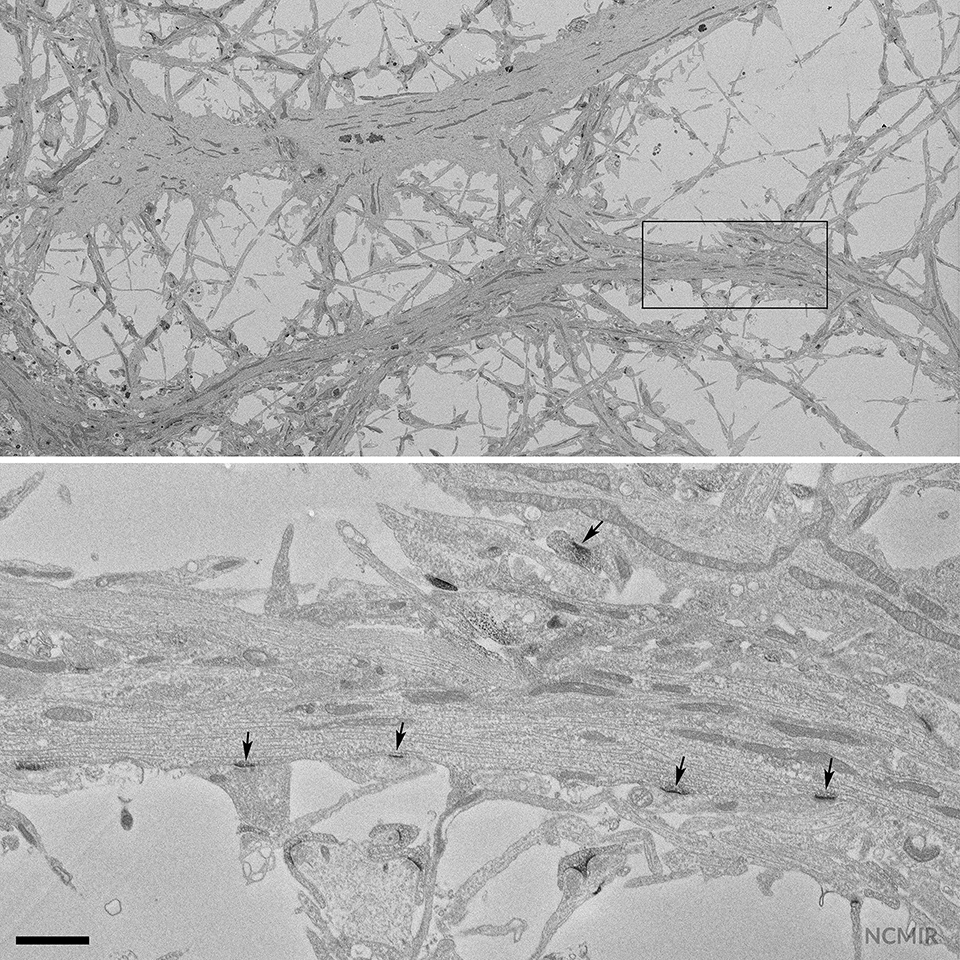 Block face sample imaged at 2.5 keV, 1 μs pixel dwell time and high vacuum using Focal Charge Compensation device. Scale bar: 1 μm. Courtesy of NCMIR. 