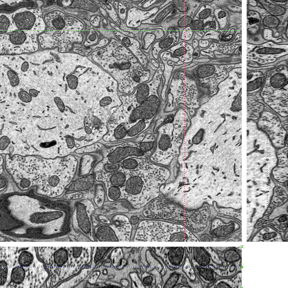 Cerebro de ratón captado con ZEISS Sigma con ultramicrótomo integrado, pila de 75 imágenes con píxeles de 7 nm. Micrótomo ajustado para eliminar 15 nm/corte.