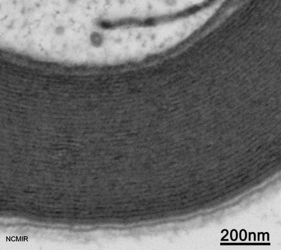 Myelin lamellae Courtesy of NCMIR.