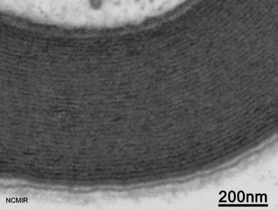 Electron micrographs provide high resolution information sufficient to count the number of single myelin lamellae and measure overall sheath thickness. 