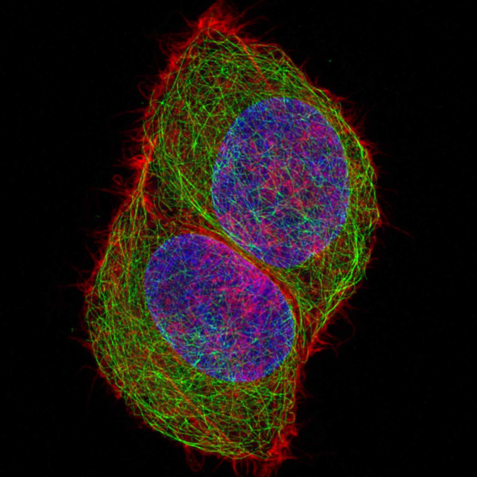 Microglia uptake of synaptic proteins within the zebrafish hindbrain at 28 days post fertilization (dpf).