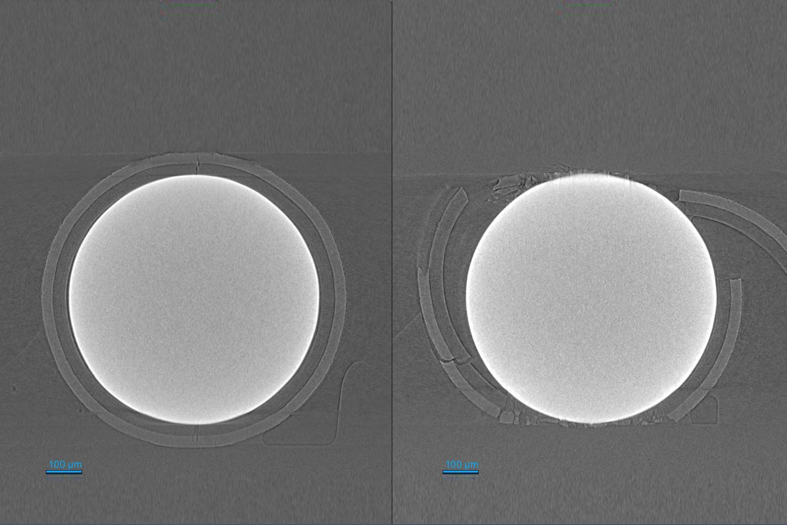 X-ray microscopy virtual slice images of a surrogate TRISO fuel particle during in situ compression in Xradia Versa with Deben CT-5kN in situ load cell. (Left) particle cracks initiate at top and bottom of the particle. (Right) brittle failure of the coating layers occurs. 