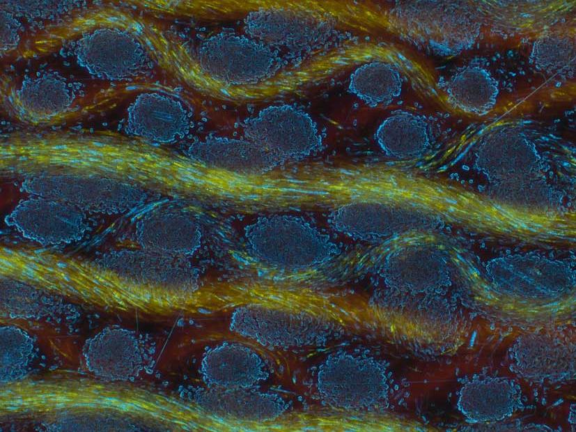 Estructura de la superficie de un mueble de madera captada con Axio Imager en campo oscuro.