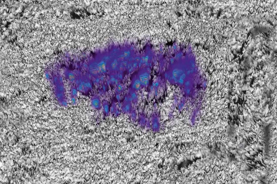  Machen Sie sich ein Gesamtbild mit Polarisations- und Konfokalmikroskopen