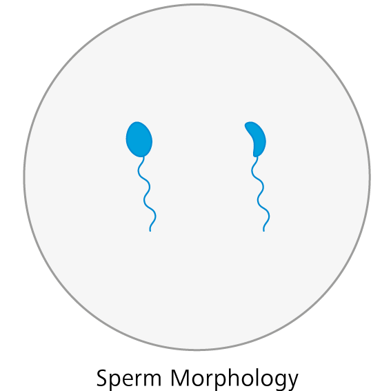 Morfología de los espermatozoides