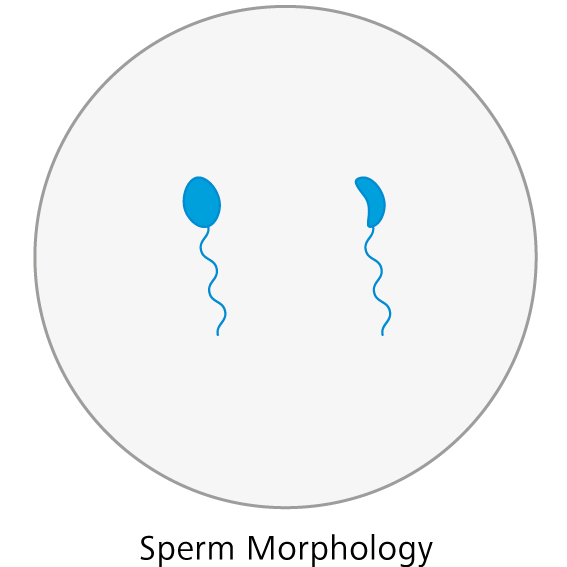 Spermienmorphologie