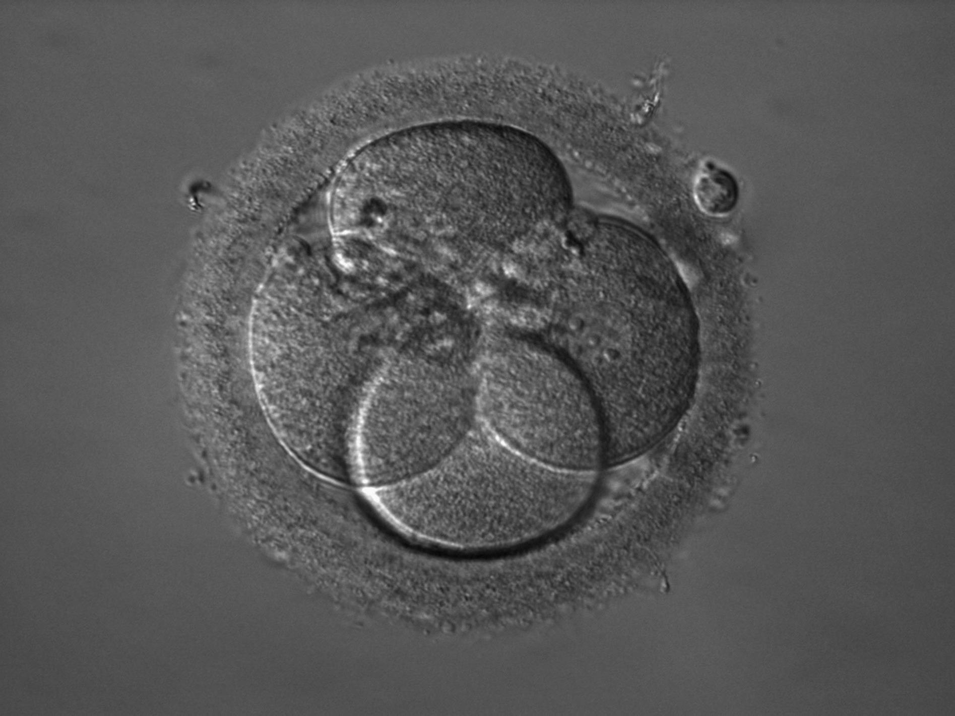 Embryon : Noyau avec nucléoles visibles dans la cellule de droite iHMC