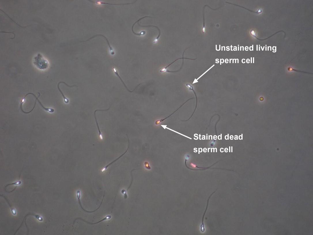 Immobile Sperm Eosine Y Vitality Test 