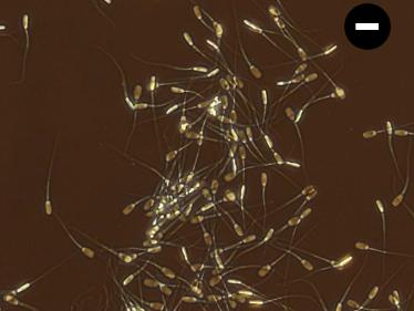 Living Spermatozoa in Negative Phase Contrast 