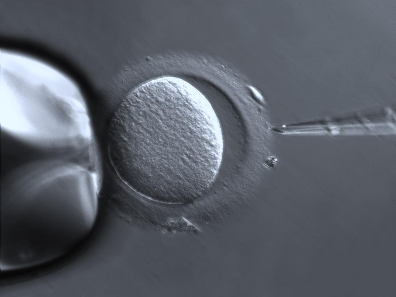 ICSI : Ovocyte avec zone pellucide, PlasDIC 