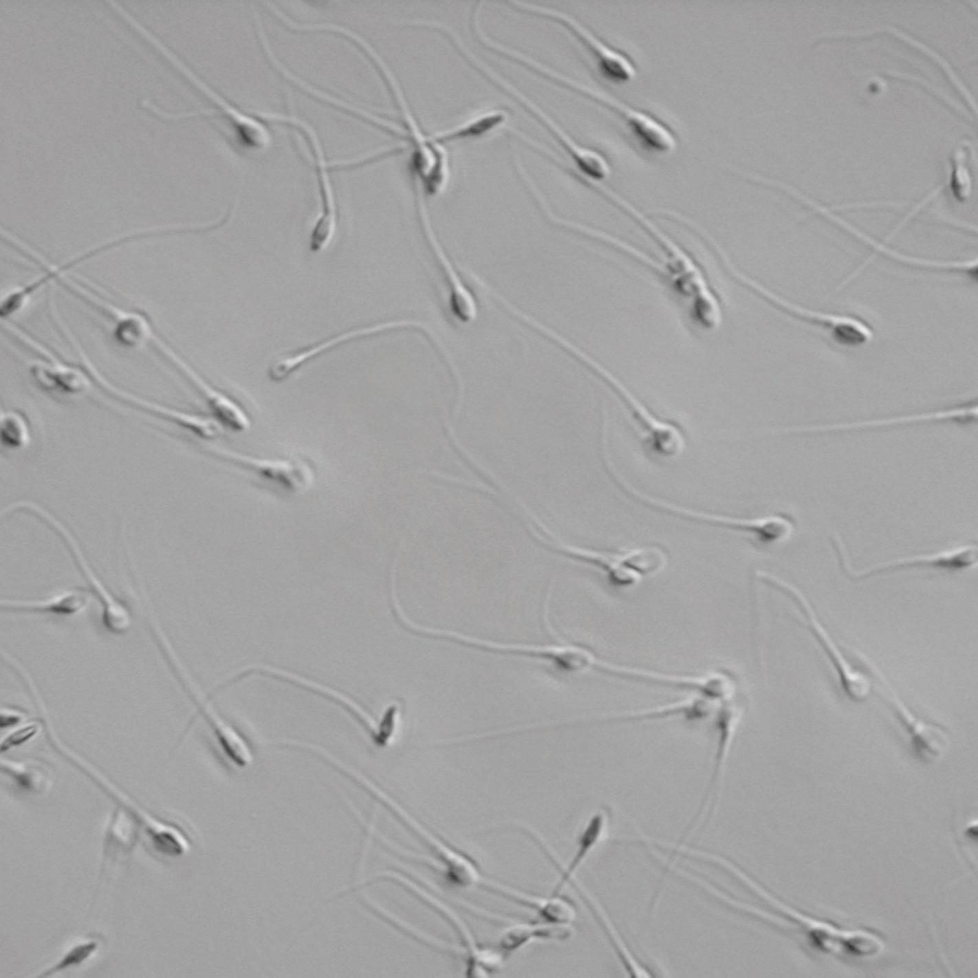 Microscopy Solutions for Semen Analysis