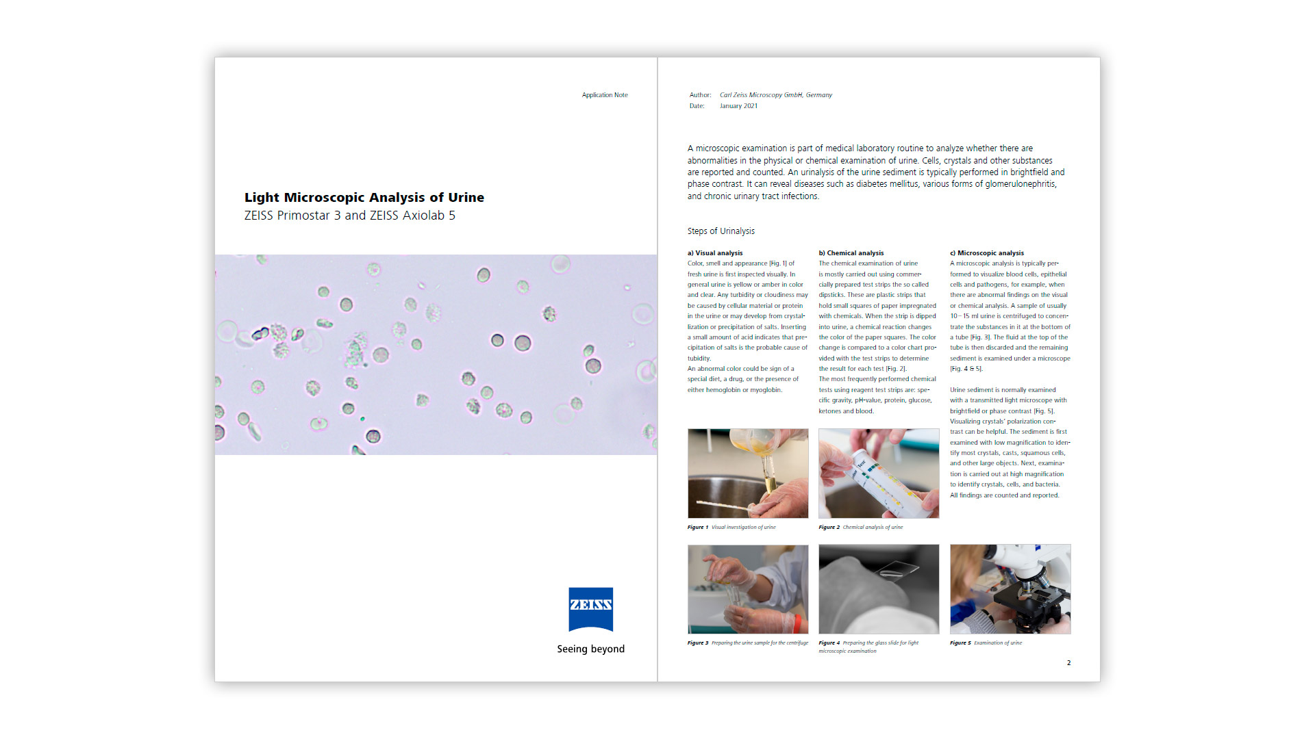 Light Microscopic Analysis of Urine - Application Note - Preview 1
