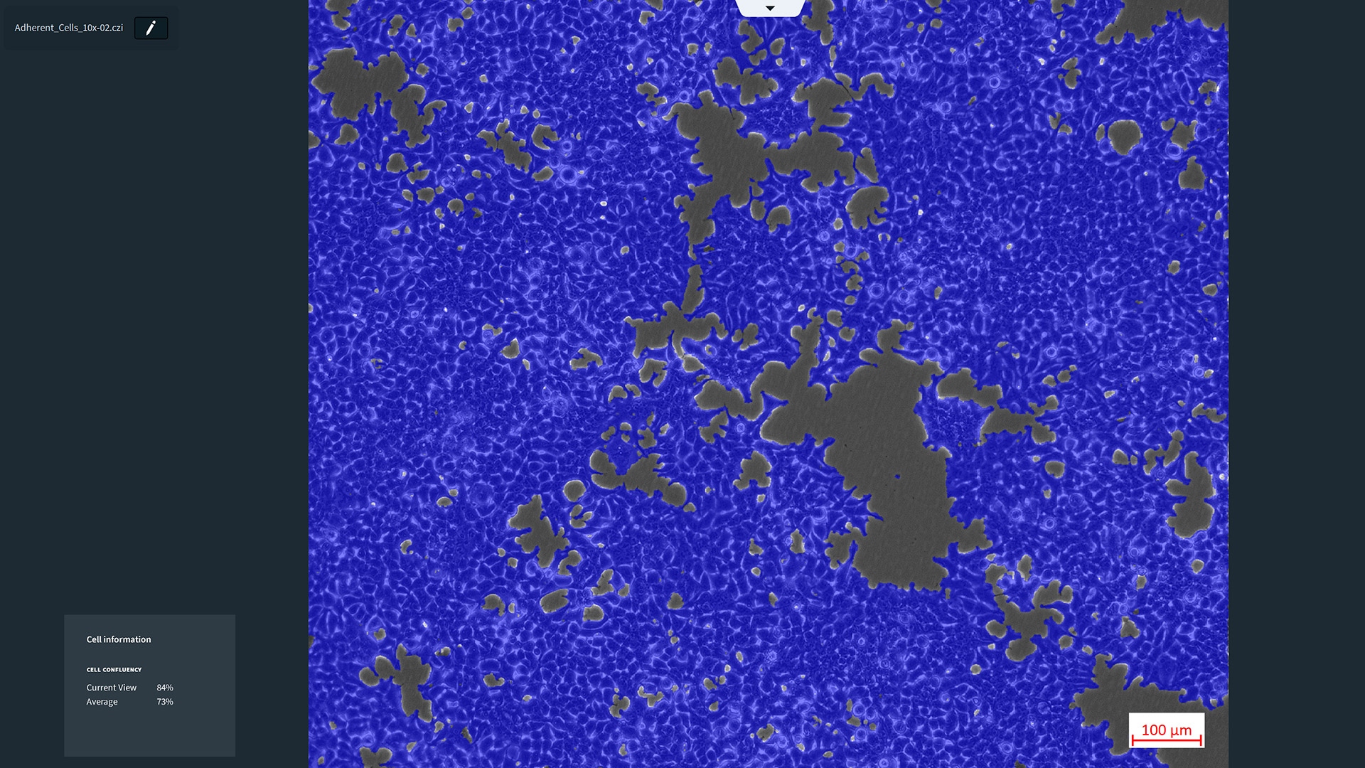 ZEISS Labscope Module - AI Cell Confluency