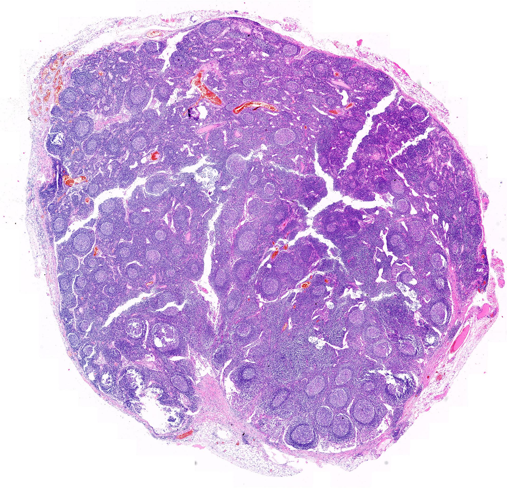 Human lymph node tissue in brightfield contrast (H&E staining)