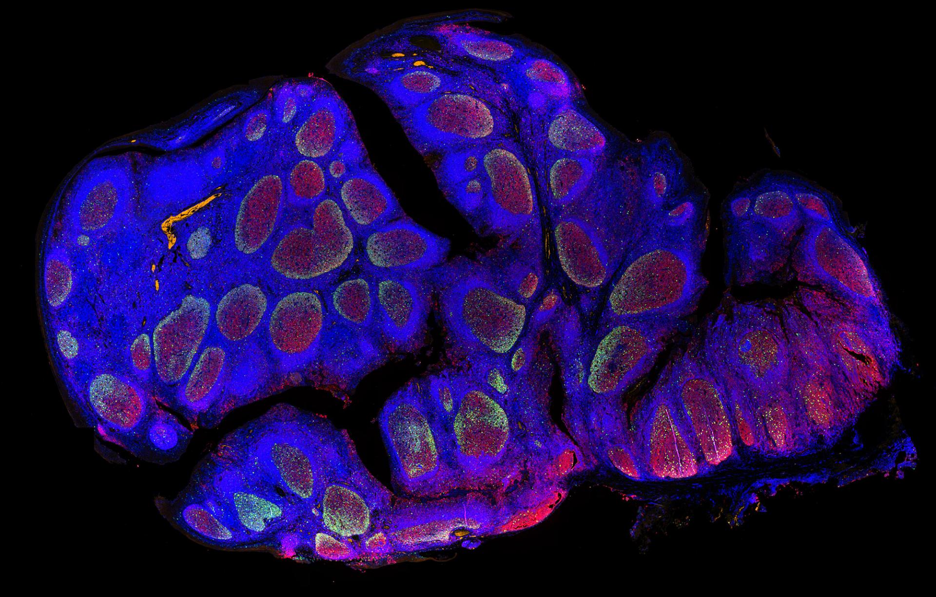 Human tonsil in fluorescence contrast