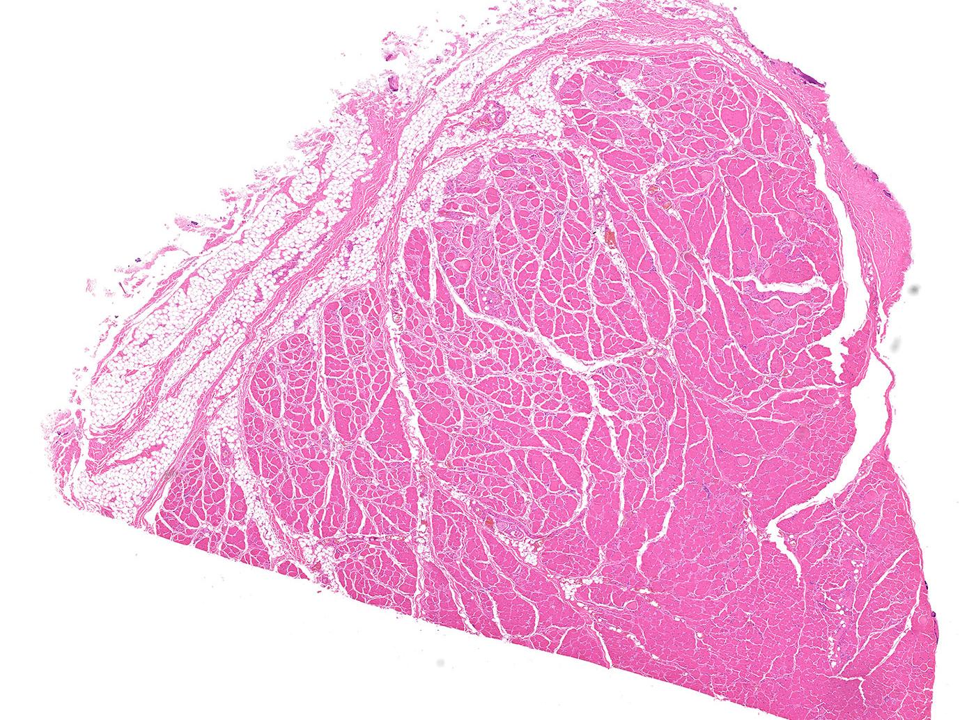 Human tissue in brightfield contrast (H&E staining)