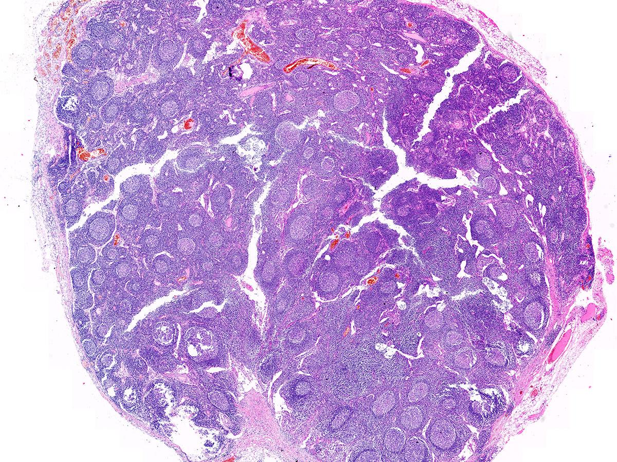 Human lymph node tissue in brightfield contrast (H&E staining)