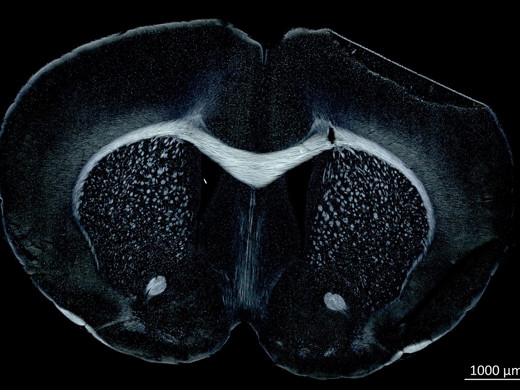 Mouse in circular polarization contrast. Image: courtesy of  Prof. Dr. Markus Morawski, Paul Flechsig Institute – Centre of Neuropathology and Brain Research, Leipzig, Germany