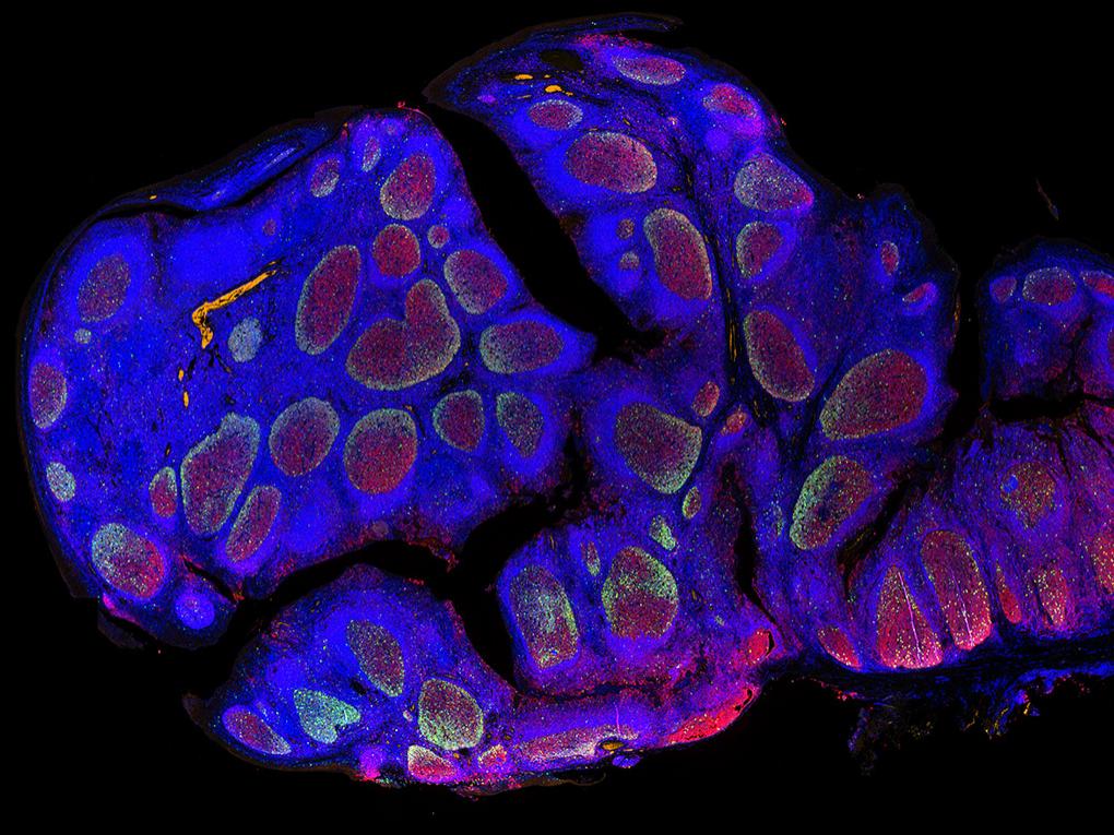Human tonsil in fluorescence contrast