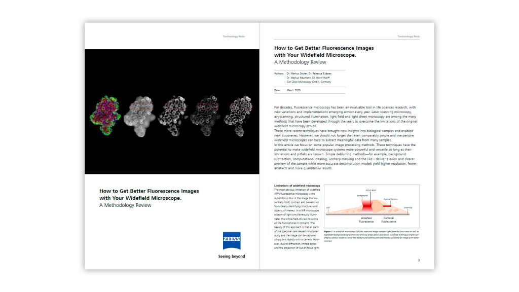 How to Get Better Fluorescence Images with Your Widefield Microscope