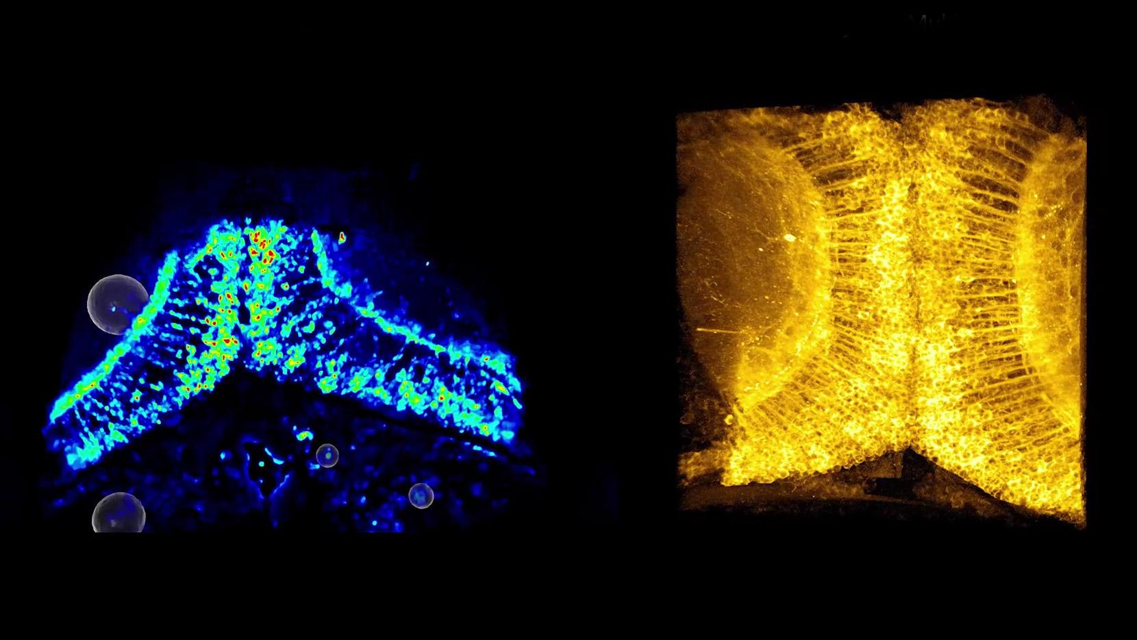 ZEISS Lightfield 4D - Combine Light-Field with Confocal Imaging