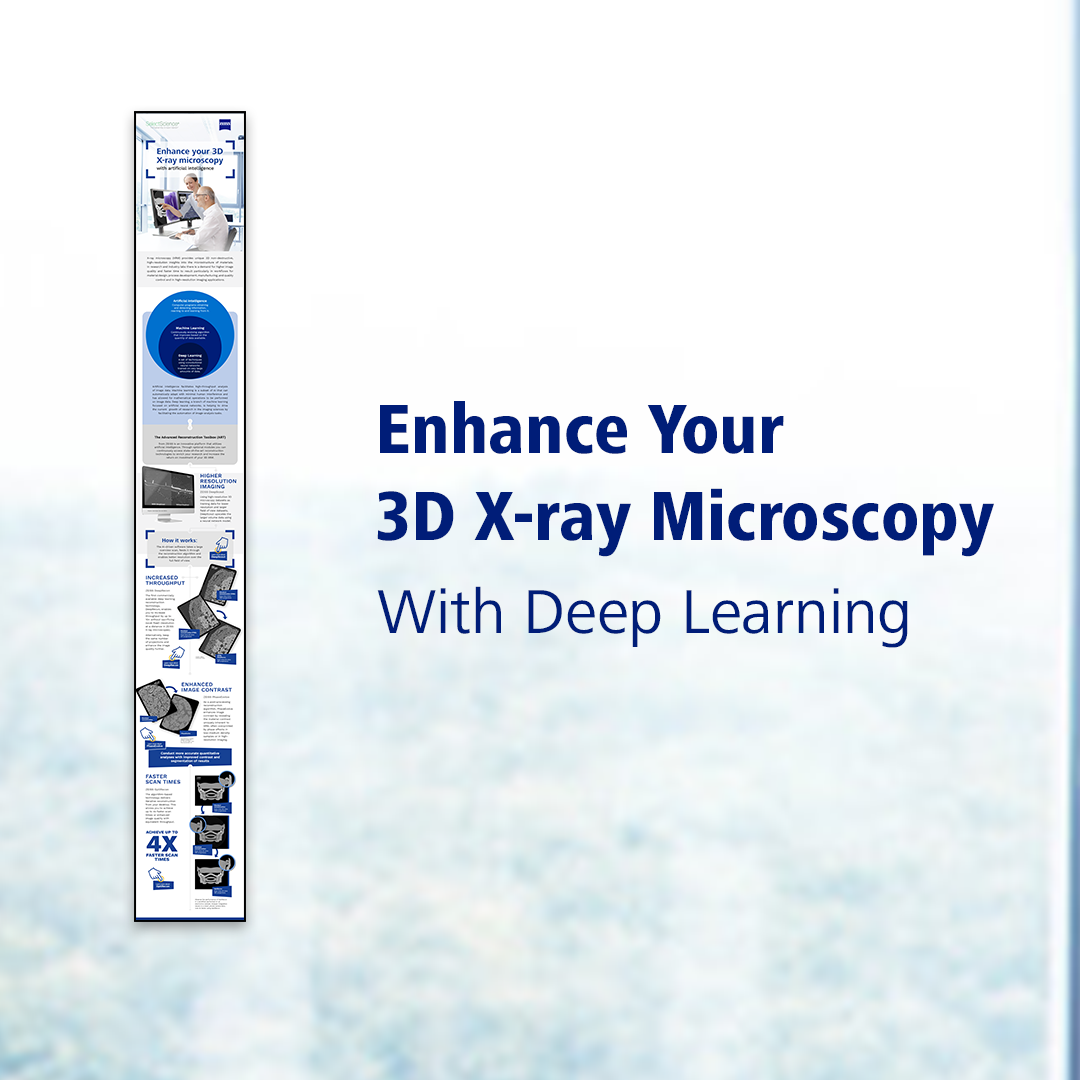 AI advancing 3d X-ray Microscopy