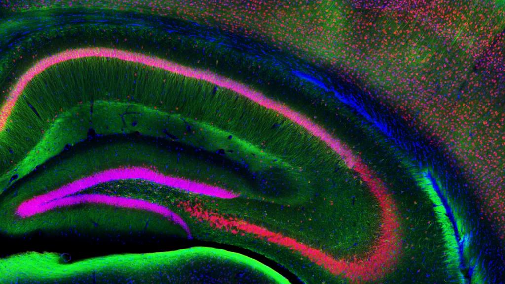 2022 ZEISS Microscopy Image Contest