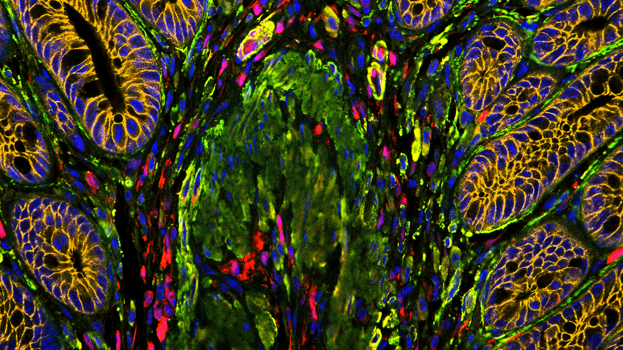 Paraffin Section of Mouse Large Intestine