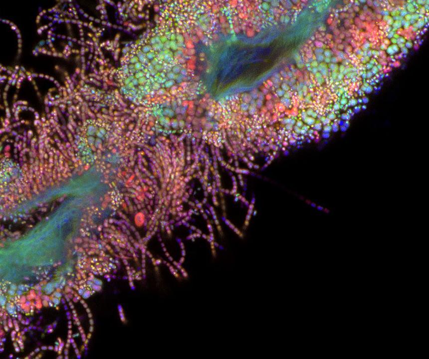 Winner in Life Sciences: Oral bacteria, acquired with ZEISS LSM 900 with Airyscan