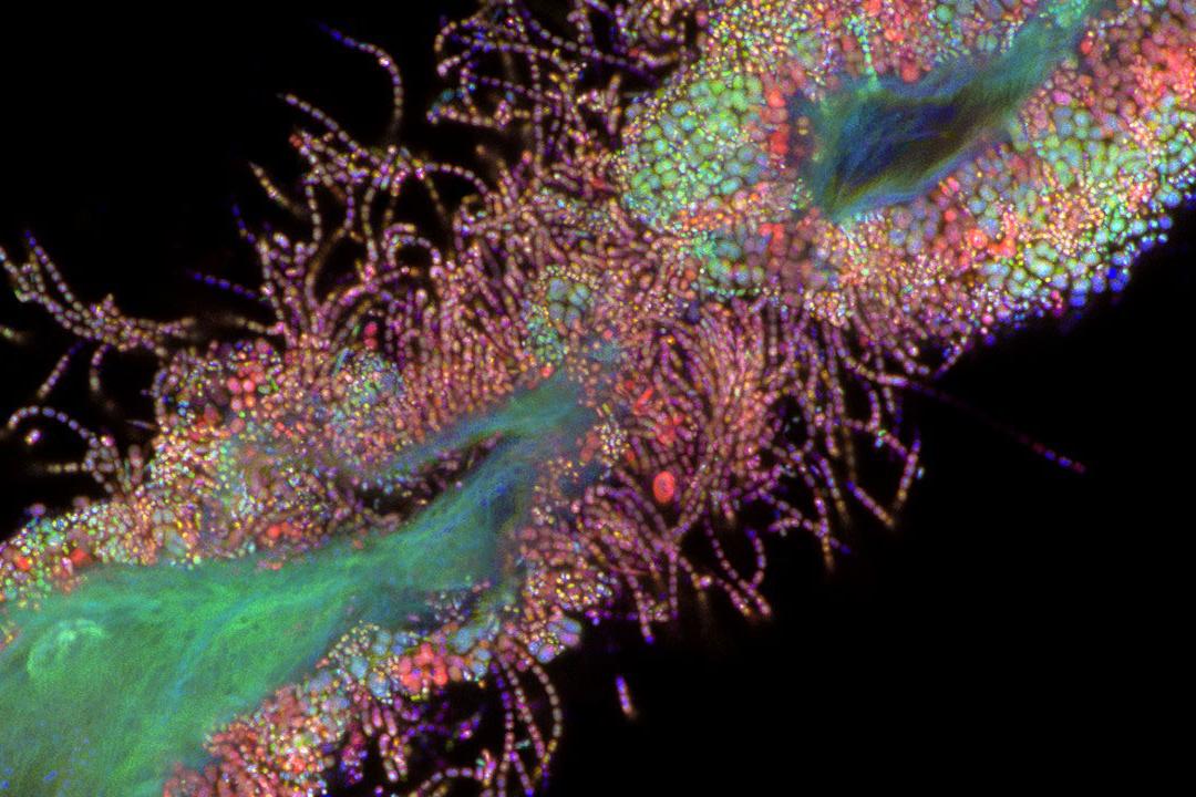 Oral bacteria, acquired with ZEISS LSM 900 with Airyscan