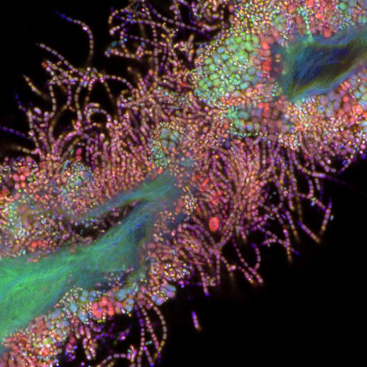 Winner in Life Sciences: Oral bacteria, acquired with ZEISS LSM 900 with Airyscan