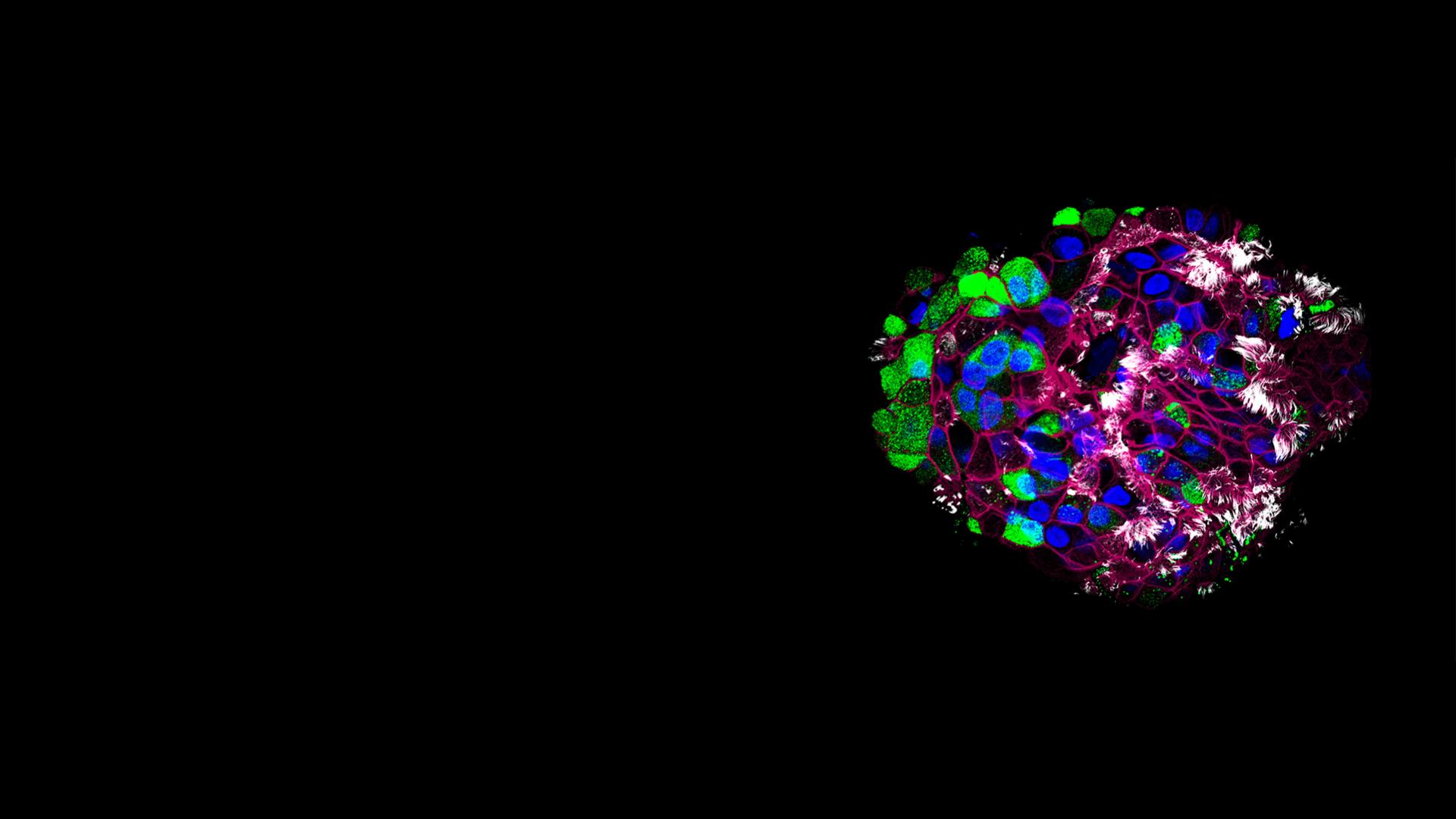 Human-Distal-Lung-Organoid