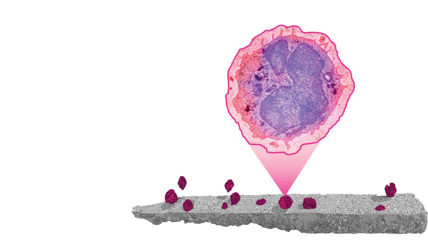 ImmunoExplorers: Correlative and multimodal imaging of immune cells in human kidney biopsies using X-rays, light, and electrons. Image credits of Roufosse team/Collinson team/Duke team/Schwab team/Uhlmann team