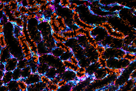 Webinar - Unraveling the Tumor Microenvironment with ZEISS Spatial ...