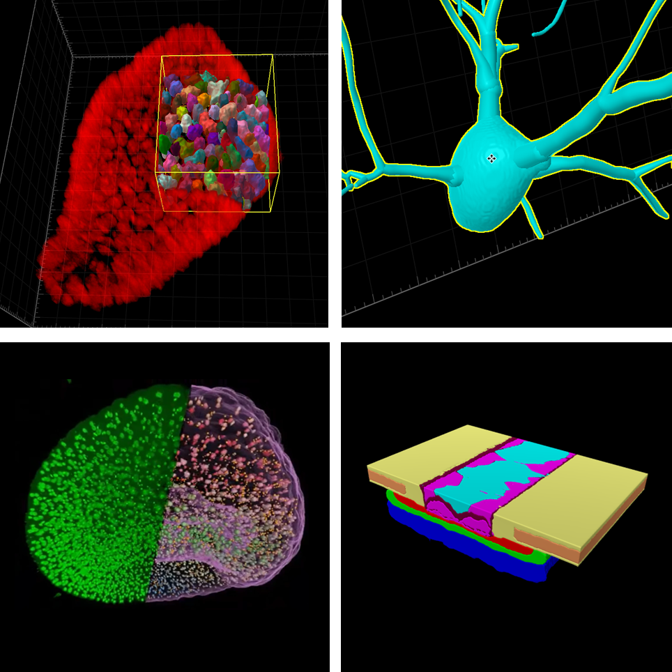 Four images showing results of advanced image analysis of microscopy images in diverse applications. Top left: 3D organoid cellular analysis. Top right: neuron tracing. Bottom left: nuclei and micronuclei counting in an embryo. Bottom right: Material analysis.