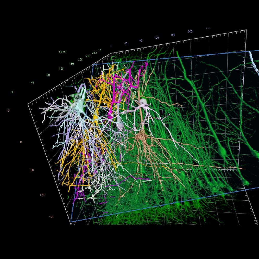 Neurons in microscopy image traced and color marked
