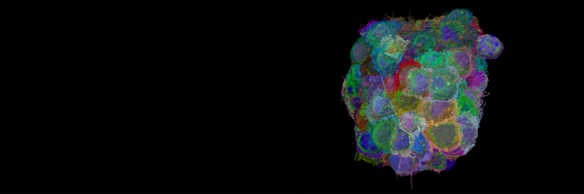 AI-based analysis of drug response in 3D ovarian cancer cultures.