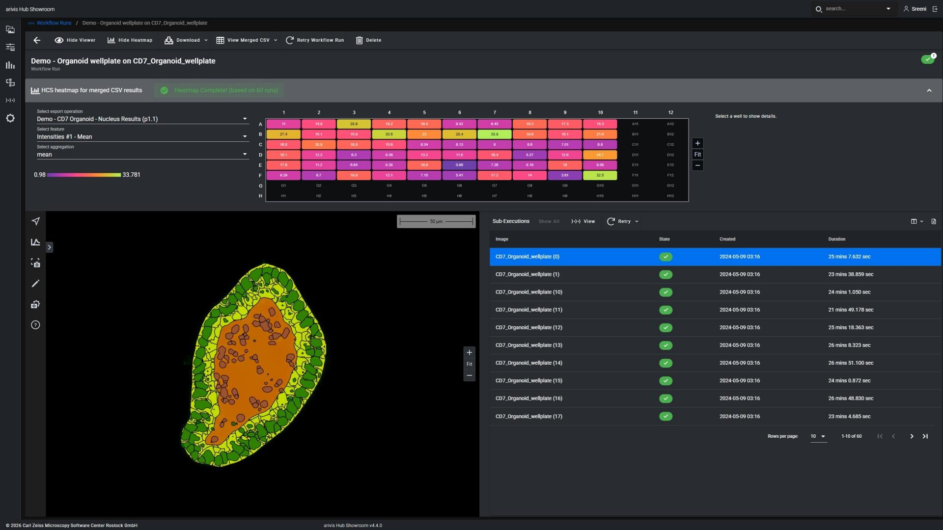 Accelerate 3D Organoid Drug Discovery with AI-Powered Analysis
