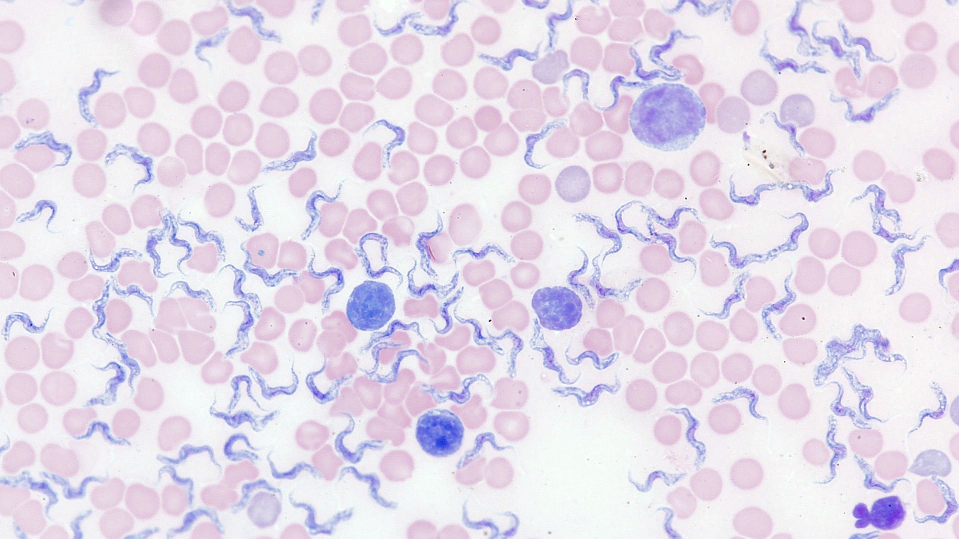 Blood smear in transmitted light brightfield