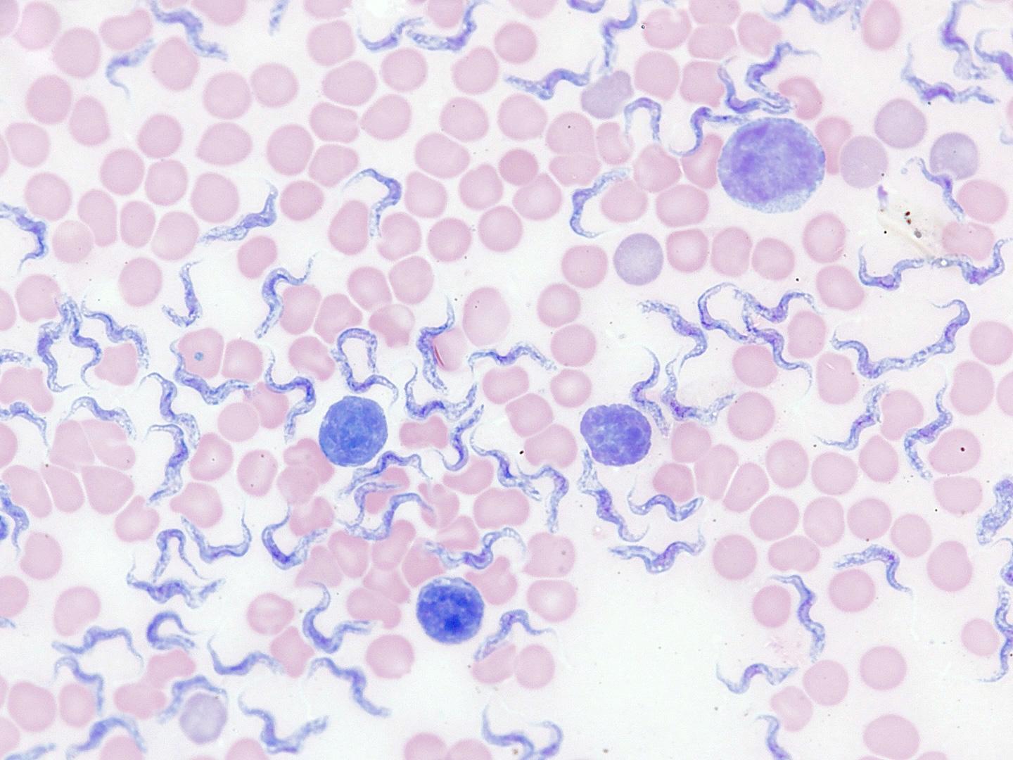 Blood smear in transmitted light brightfield