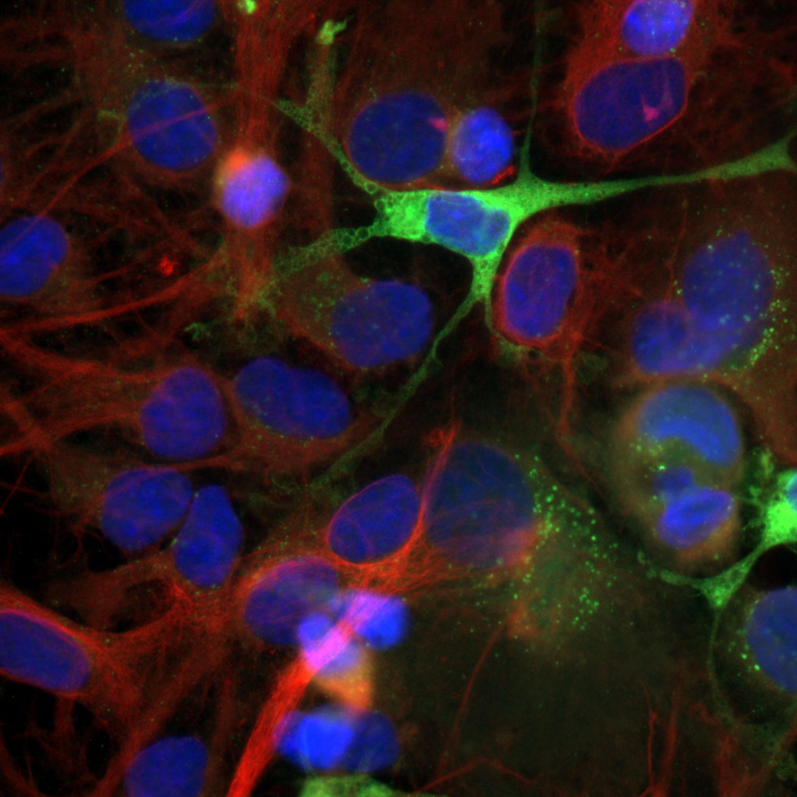 Astrocytes. Green: GFP, red: tubulin – Alexa 568, blue: Hoechst 33342, acquired with ZEISS Axio Imager.D2, objective: Plan APOCHROMAT 63× / 1.4