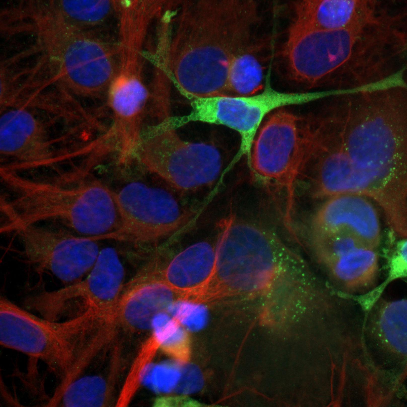 Astrozyten. Grün: GFP, rot: Tubulin – Alexa 568, blau: Hoechst 33342, aufgenommen mit ZEISS Axio Imager.D2, Objektiv: Plan-APOCHROMAT 63×/1,4