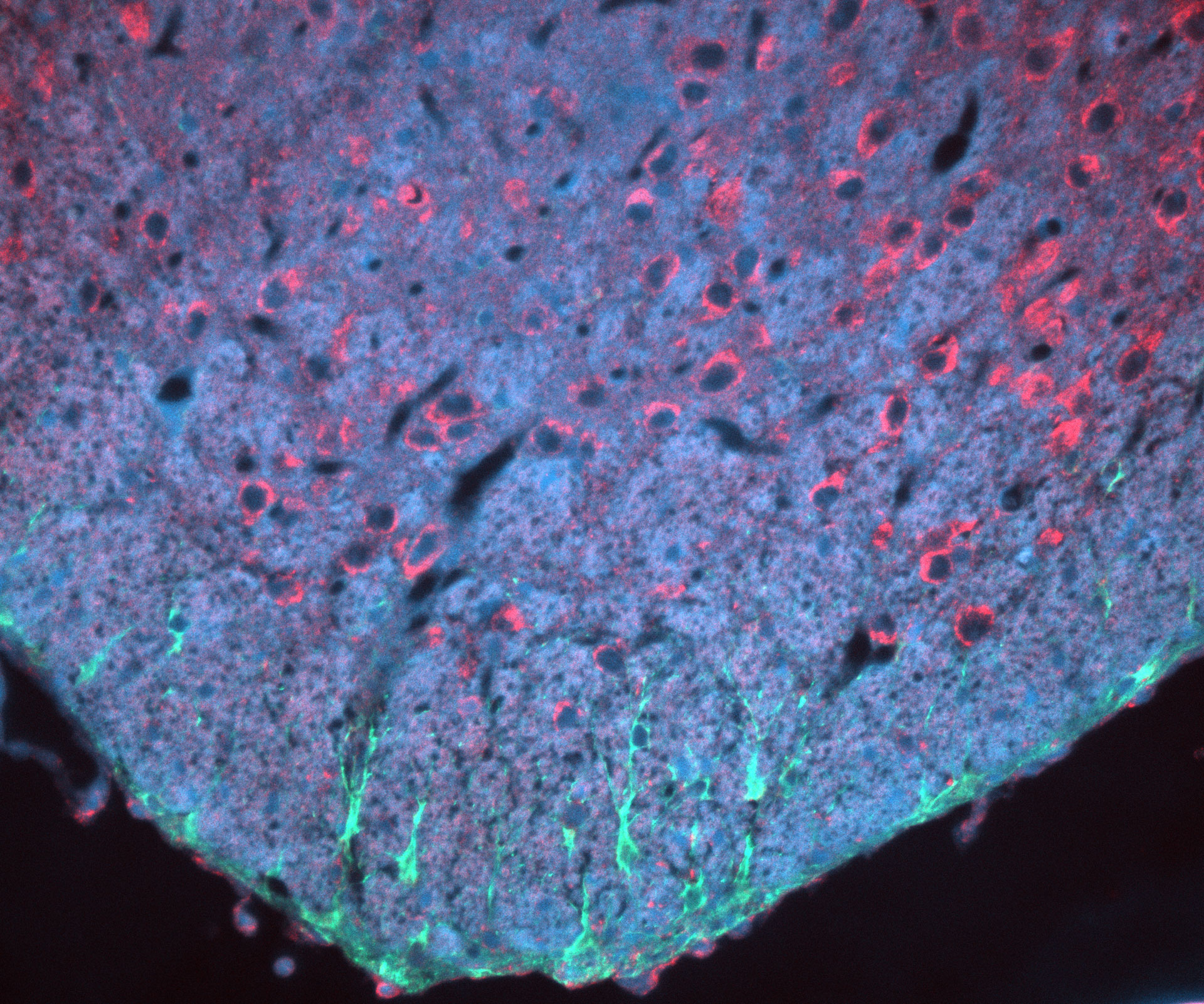 Coloration des anticorps d'une coupe de cerveau d'une souris. Noyaux cellulaires (bleu), astrocytes (vert), cytokératine (rouge), image capturée avec ZEISS Axio Imager, objectif : EC Plan-NEOFLUAR 20x/0,50 