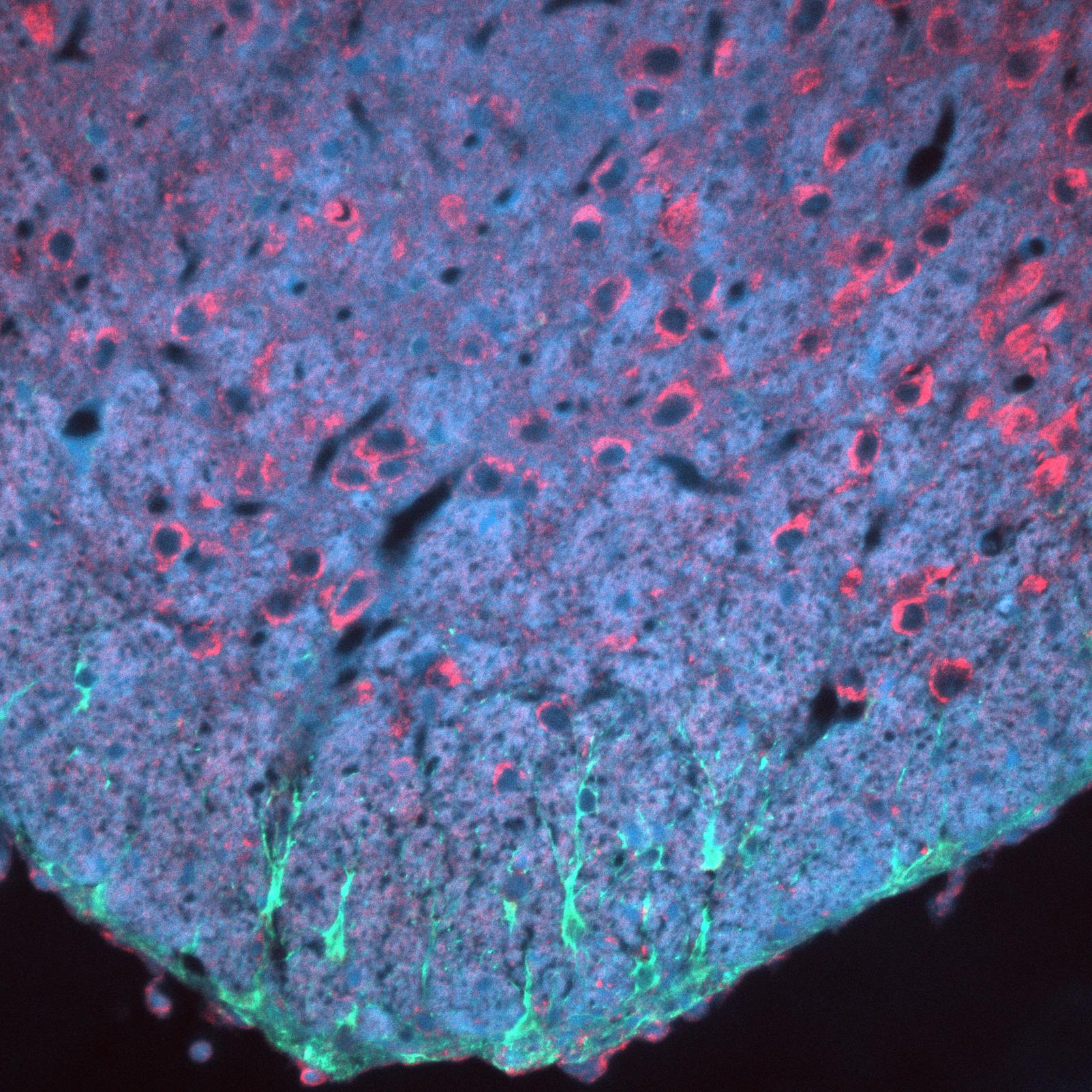 Tinción con anticuerpos de la sección del cerebro de un ratón. Núcleos celulares (azul), astrocitos (verde), citoqueratina (rojo), capturados con ZEISS Axio Imager, objetivo: EC Plan-NEOFLUAR 20×/0,50