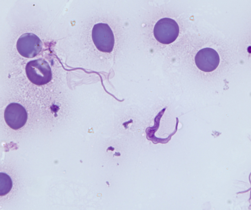 Parásito Trypanosoma brucei gambiense en frotis de sangre humana. Tinción de Giemsa. Imagen capturada con el objetivo de inmersión en aceite ZEISS Plan-Apochromat 63x/1,4. 
