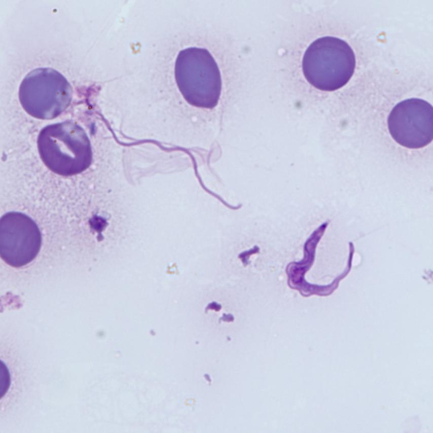 Parásito Trypanosoma brucei gambiense en frotis de sangre humana. Tinción de Giemsa. Imagen capturada con el objetivo de inmersión en aceite ZEISS Plan-Apochromat 63×/1,4.