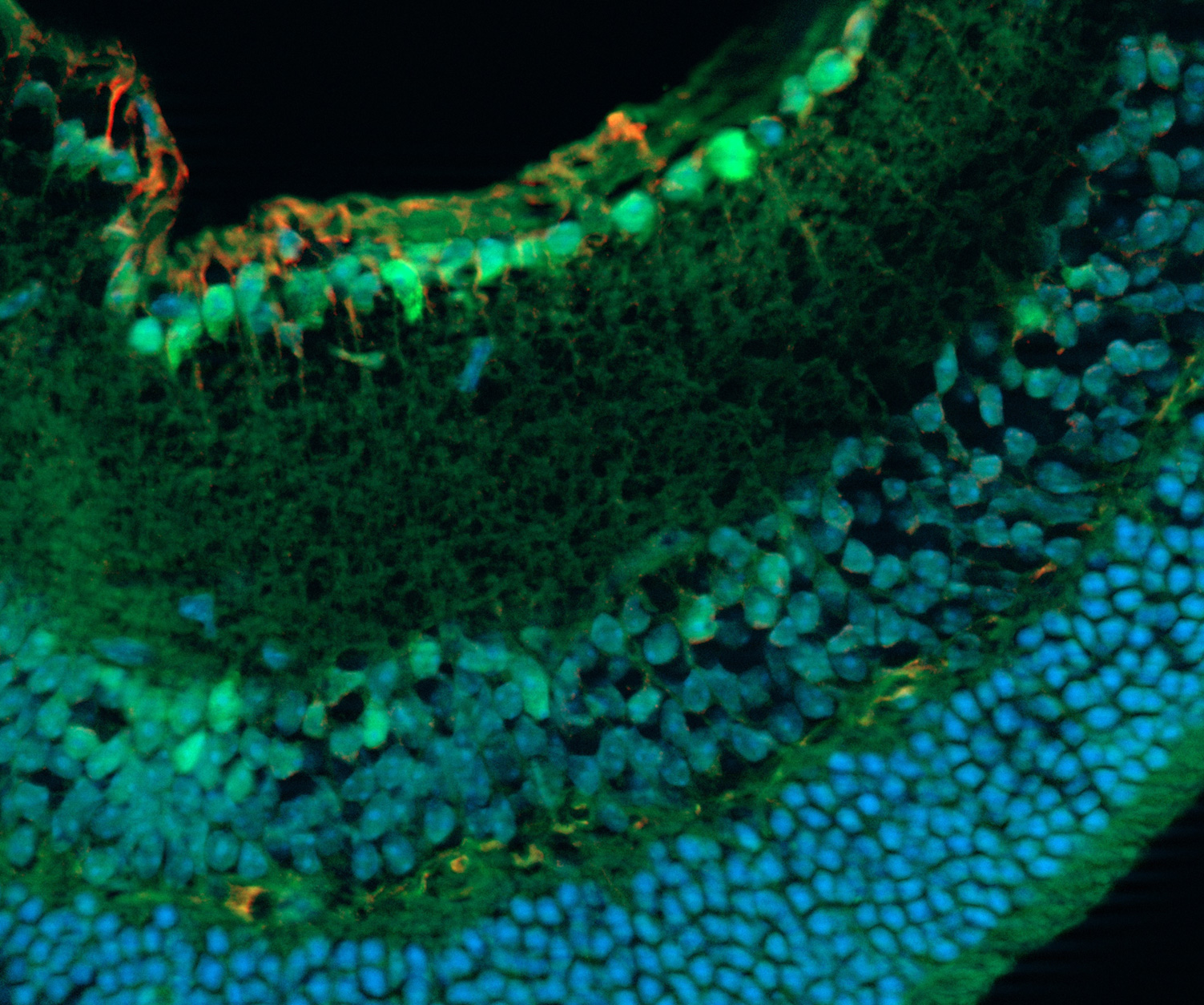 Fixierter Mäuse-Retinaschnitt. Aufgenommen mit ZEISS Apotome.2. Proben mit freundlicher Genehmigung von: S. Nan und P. Heiduschka, Klinik für Augenheilkunde, Universitätsklinikum Münster, Deutschland.