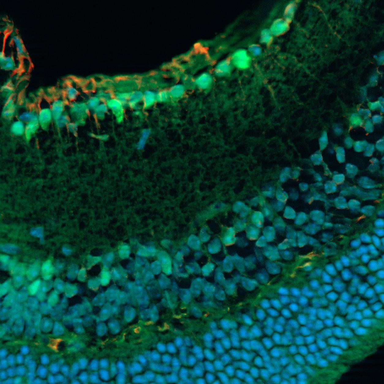 Fixed mouse retina section. Acquired with ZEISS Apotome.2. Specimen courtesy of S. Nan and P. Heiduschka, Department of Ophthalmology, University Medical Center Münster, Germany.