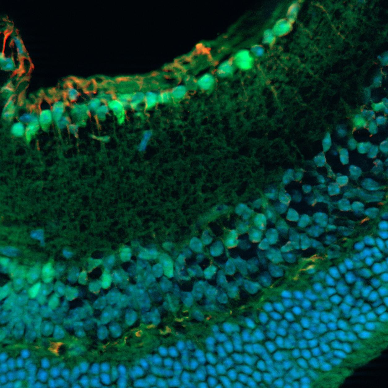 Fixierter Mäuse-Retinaschnitt. Aufgenommen mit ZEISS Apotome.2. Proben mit freundlicher Genehmigung von: S. Nan und P. Heiduschka, Klinik für Augenheilkunde, Universitätsklinikum Münster, Deutschland.