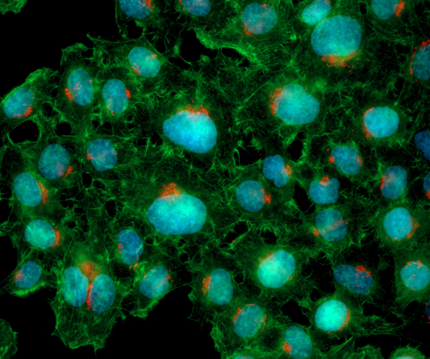 Cultivo fijado de células HeLa. Azul: ADN (DAPI), verde: actina F (faloidina-Alexa Fluor 488), rojo: red del trans Golgi (TGN-Alexa Fluor 561) 